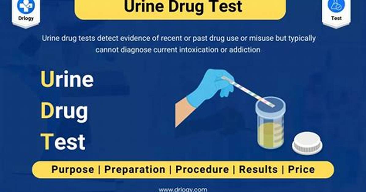 Does Uil Drug Test?