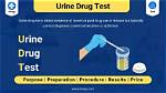 Does Uil Drug Test?