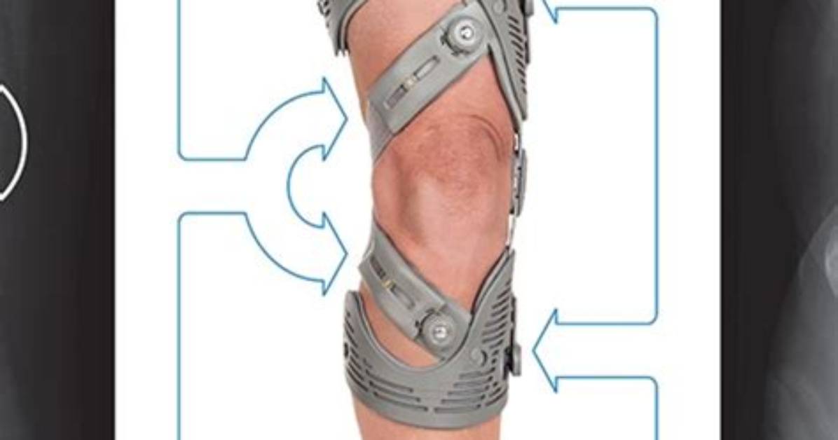 Does Unloader Brace Work?