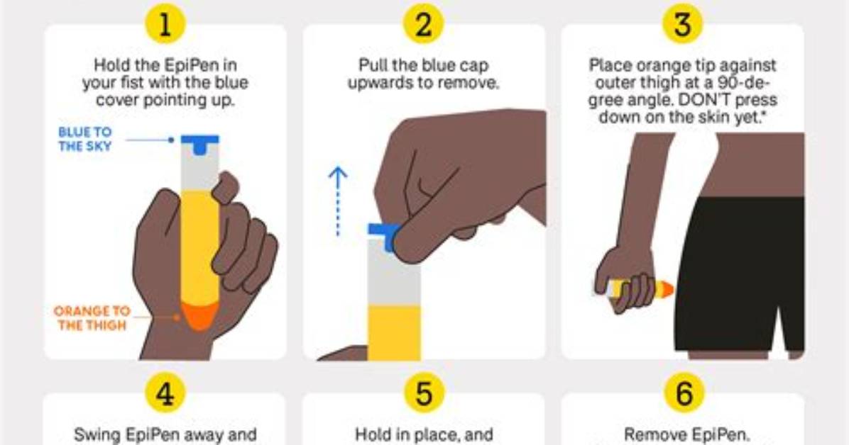 Does Using an Epipen Hurt?