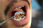 Does Vaping Stain Your Teeth?