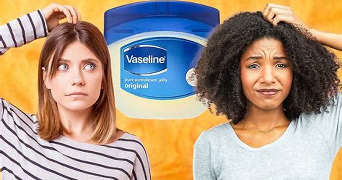 Does Vaseline Stop Itching?