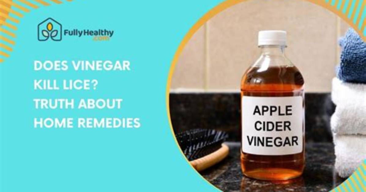 Does Vinegar Kill Lice?