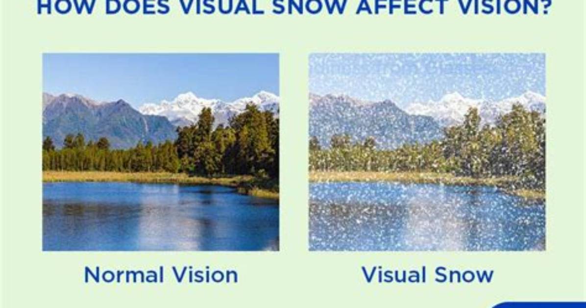 Does Visual Snow Cause Afterimage?