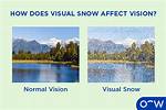 Does Visual Snow Cause Afterimage?