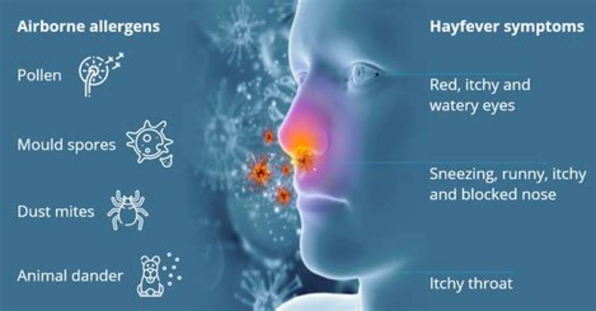 Does Wattle Cause Hayfever?