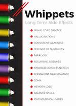 Does Whippets Kill Your Brain Cells?