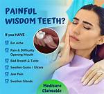 Does Wisdom Teeth Hurt?