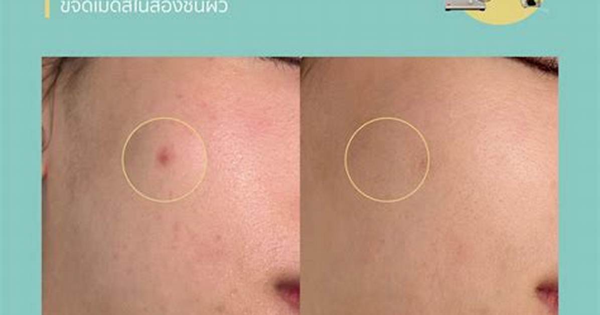 Does Yellow Correct Redness?