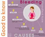 During Conception Do You Bleed?