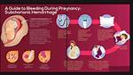 During Pregnancy Internal Bleeding?