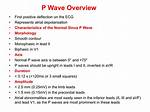 During the P Wave?