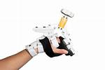 Dynamic Splinting
