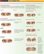 Dysconjugate