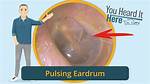 Ear Drum Spasm