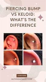 Ear Piercing Bump