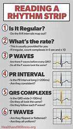 Ecg Strip