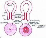 Ectropion Cervix