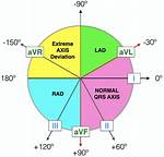 Ekg Axis