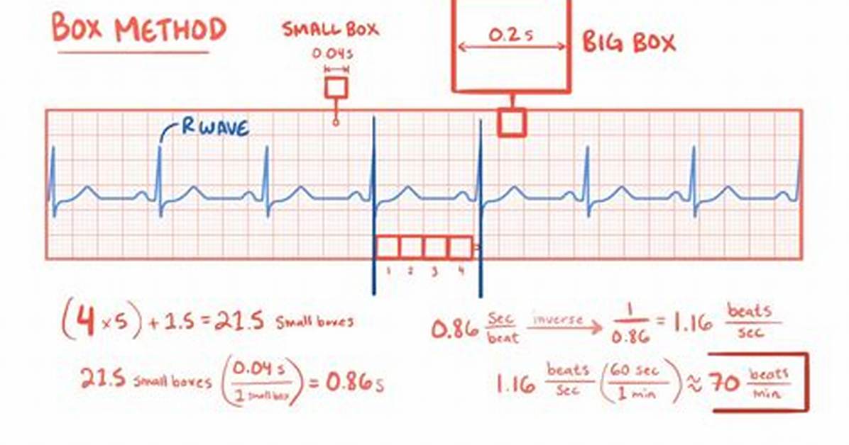 Ekg Boxes