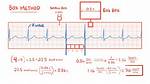 Ekg Boxes