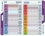 Ekg Strip