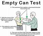 Empty Can Test