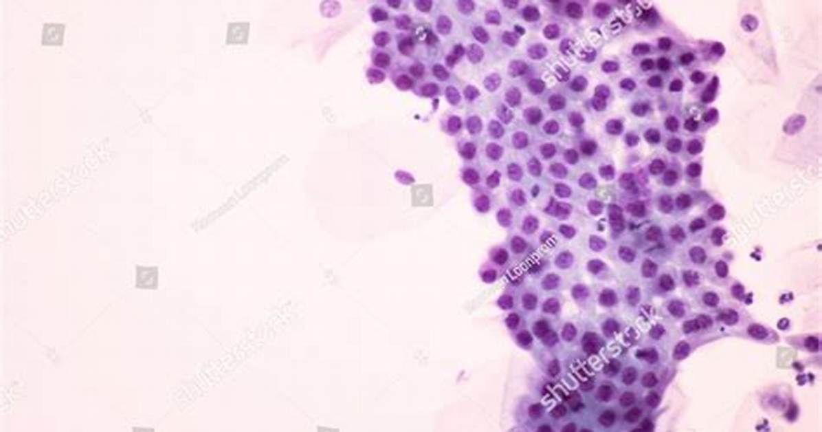 Endocervical Cells