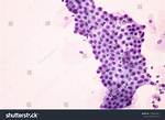 Endocervical Cells