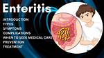 Enteritis Treatment