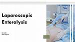 Enterolysis