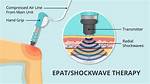 Epat® Therapy