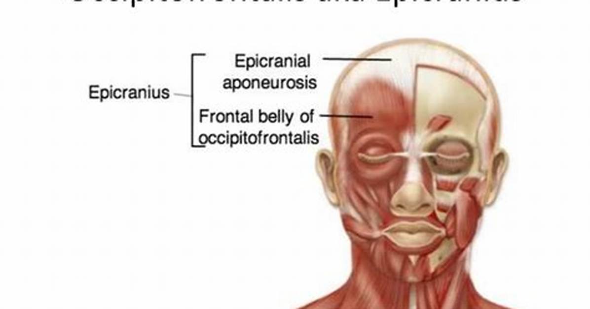 Epicranius