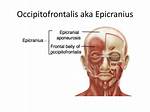 Epicranius