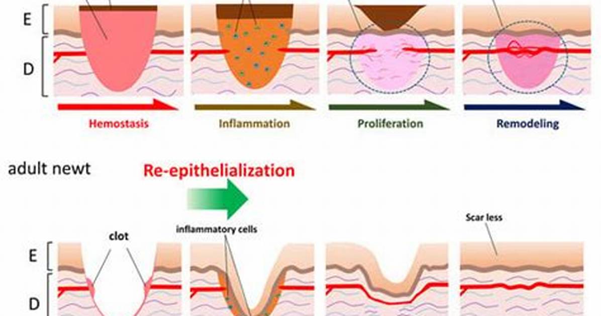 Epithelialization Definition