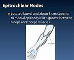 Epitrochlear Lymph Node