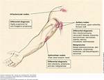 Epitrochlear Lymphadenopathy