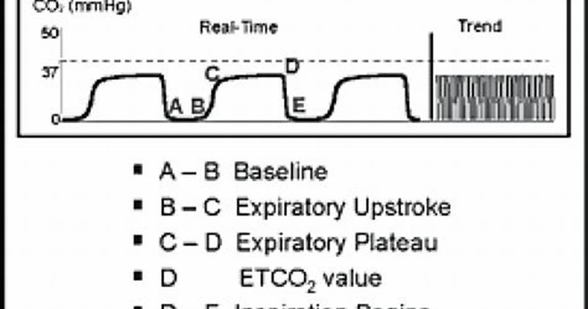 Etco2 Normal Range