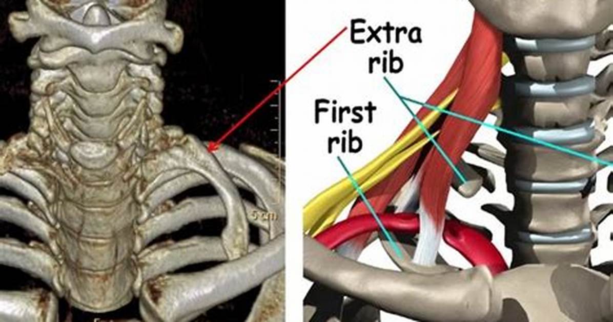 Extra Rib