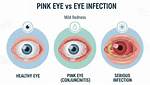 Eye Lecherously