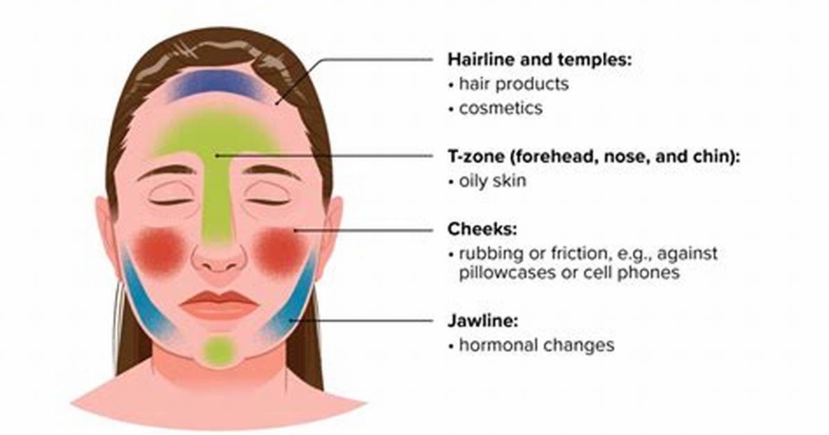 Facial Breakout