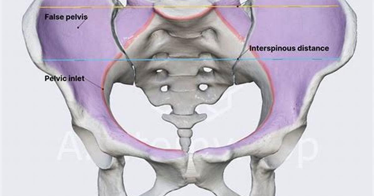 False Pelvis