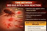 Feeling After a Bug Bite Often