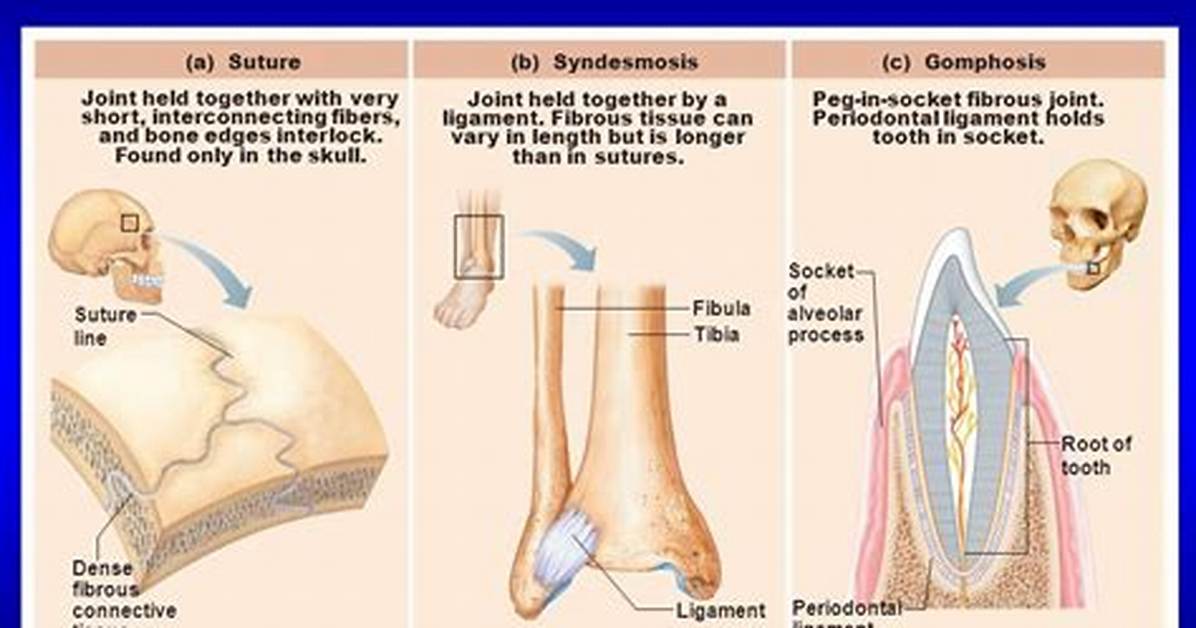 Fibrous Joint Example