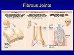 Fibrous Joints Examples