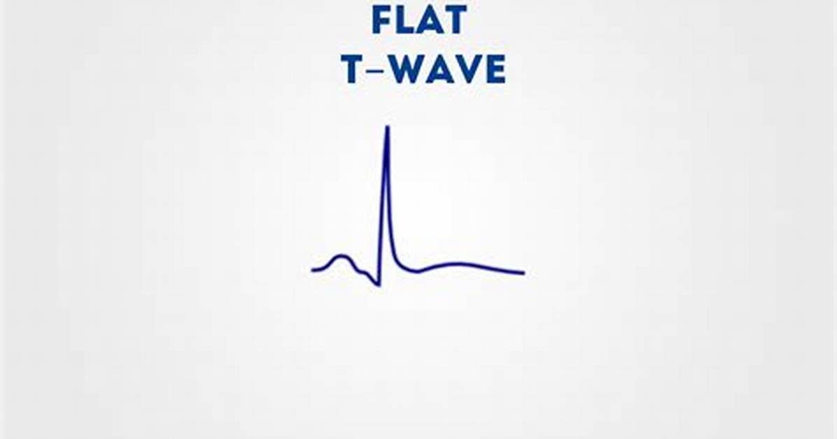 Flat T Waves