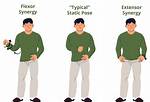 Flexor Synergy Pattern