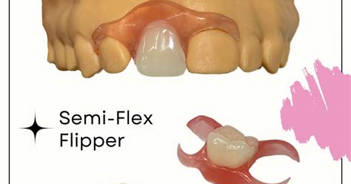 Flipper Tooth Cost