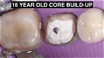 For Core Build up?