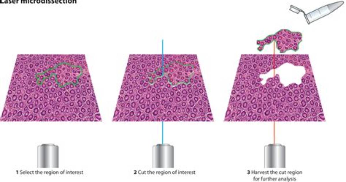 For Laser Capture Microdissection?